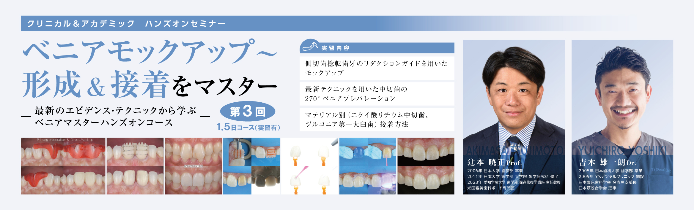 ベニアモックアップ～形成＆接着をマスター　～最新のエビデンス・テクニックから学ぶ　ベニアマスター ハンズオン～