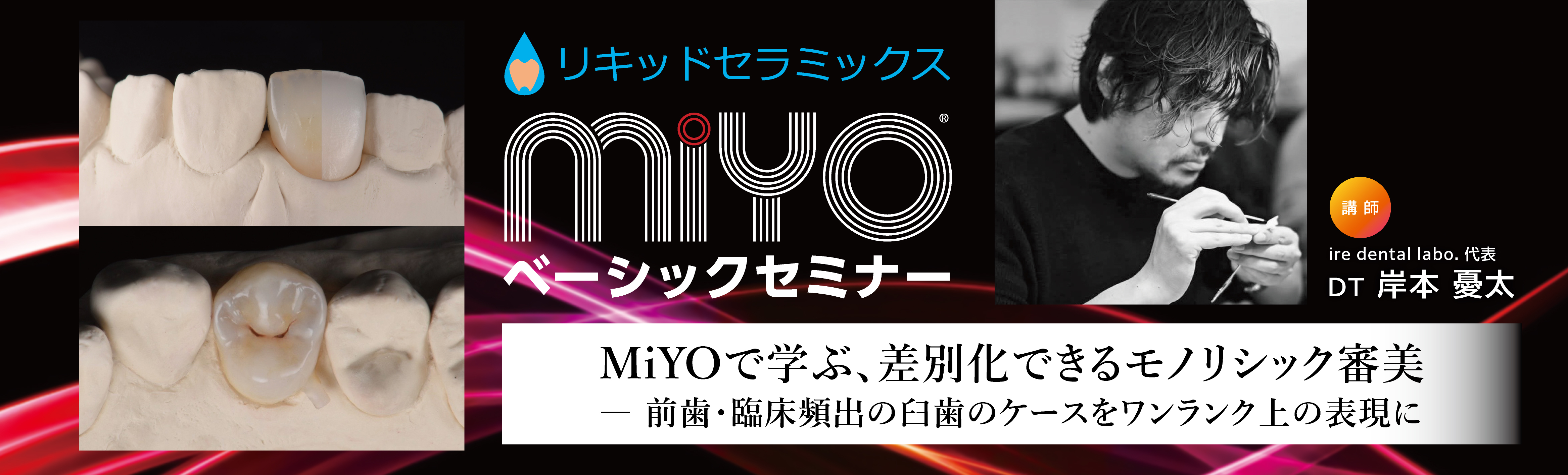 MiYOで学ぶ、差別化できるモノリシック審美　― 前歯・臨床頻出の臼歯のケースをワンランク上の表現に